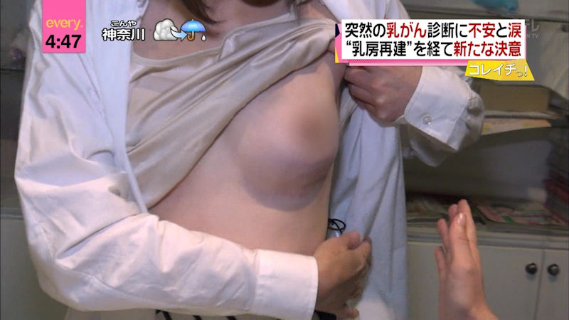 乳がん検診 おっぱい チェック TV キャプ エロ画像【20】