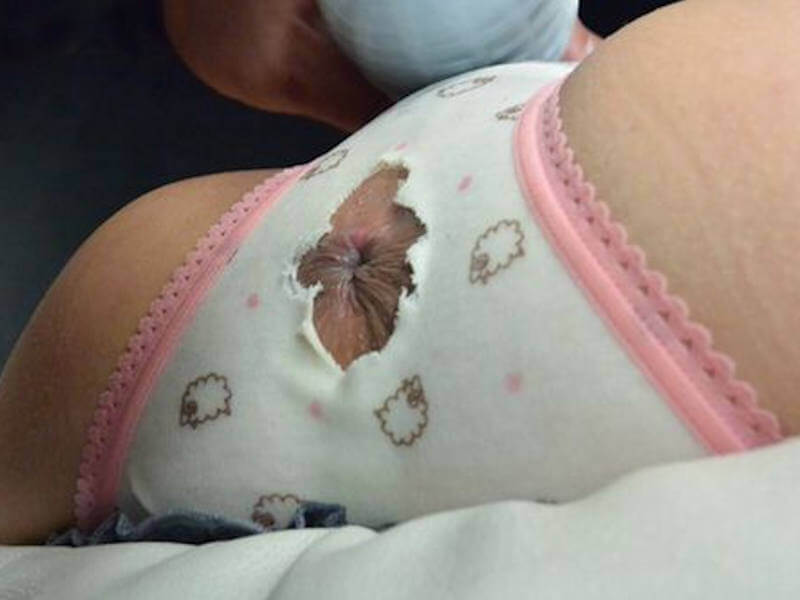 お尻の穴からアナルが露出したエロ画像